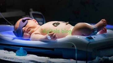 Jangan Anggap Remeh, Berikut 4 Cara Merawat Bayi Prematur yang Sakit Kuning